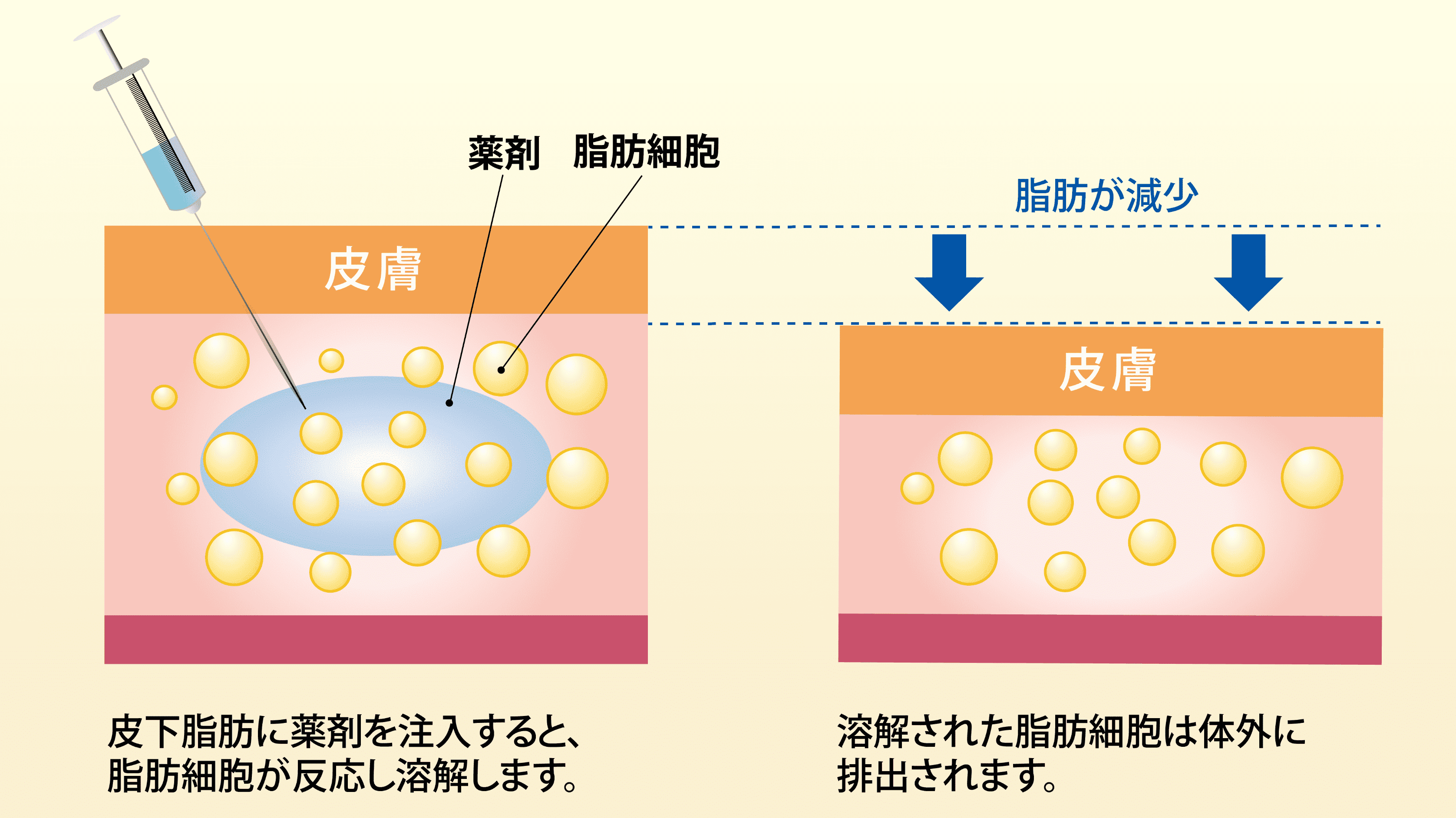 症例画像_FatXコア