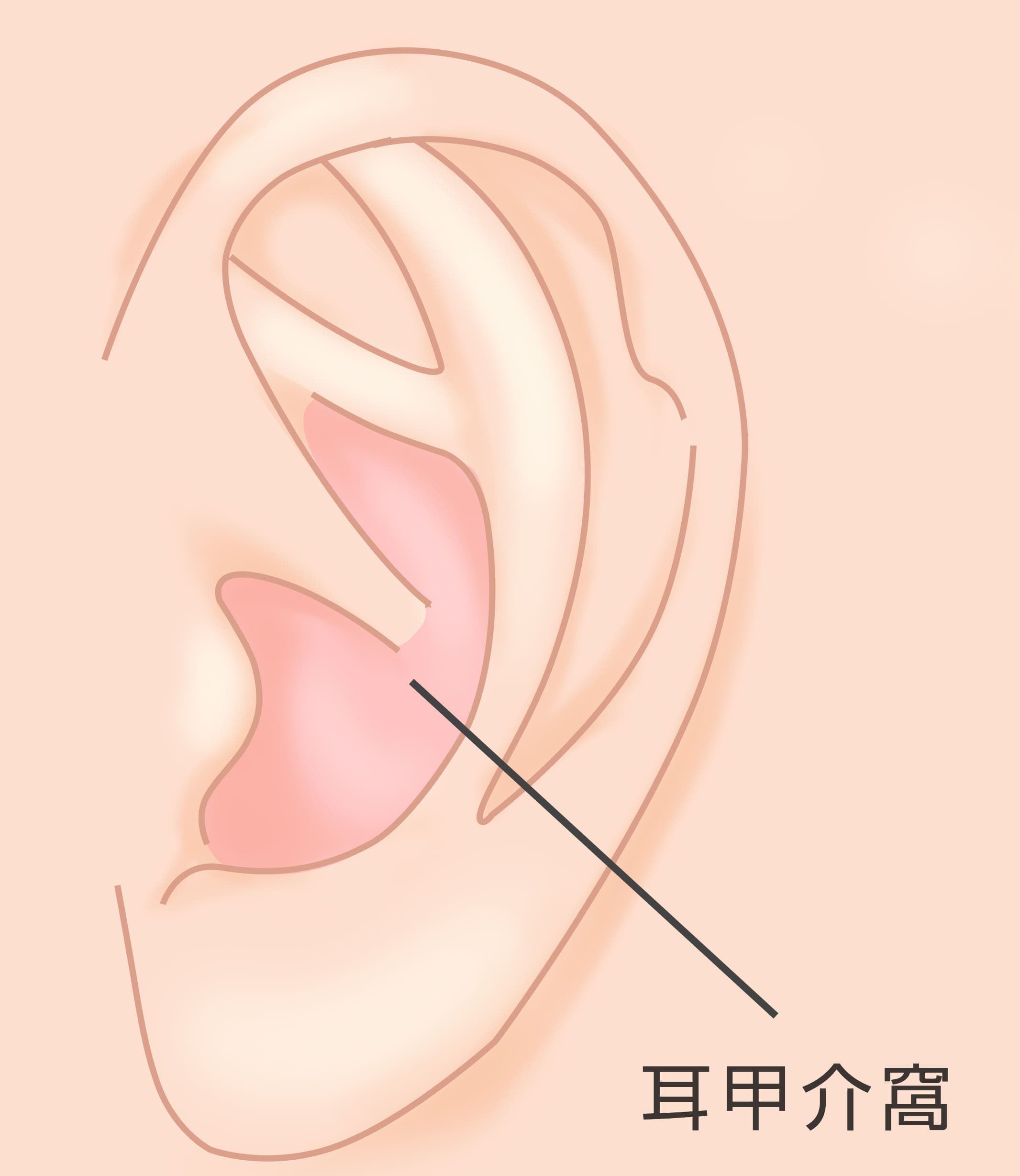 耳介形成術
