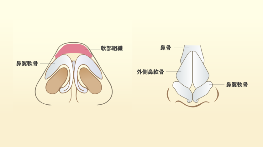 nose_constructure