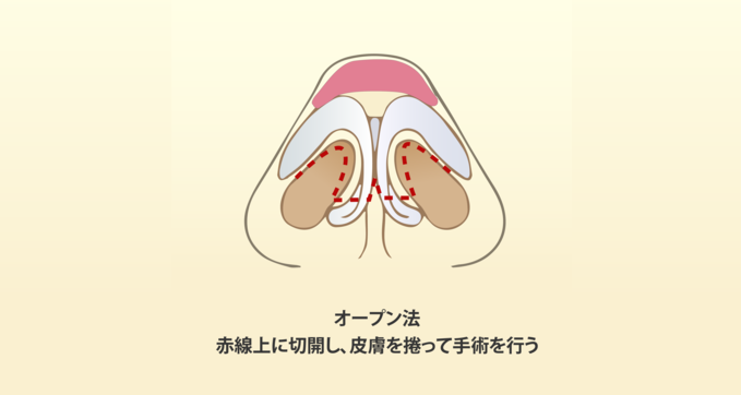 nose_constructure